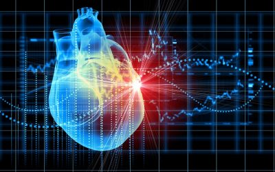 Angina is common, but frequently missed and undertreated
