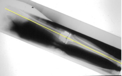 ‘Engineer knee surgeon’ pioneers technique gaining world acclaim